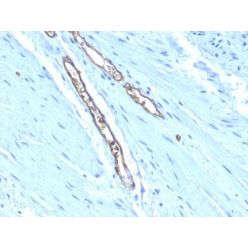Blood Group Antigen A(HE-193), 1mg/mL