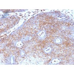 Beta-2-Microglobulin (B2M)(B2M/1118), 1mg/mL