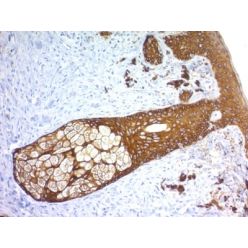 Cytokeratin, Basic (Type II or HMW) (Epithelial Marker) (KRTH/1576R), 1mg/mL
