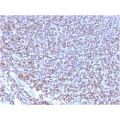 NKX2.2 (Neuroendocrine & Ewing's Sarcoma Marker)(NX2/2198R), 1mg/mL