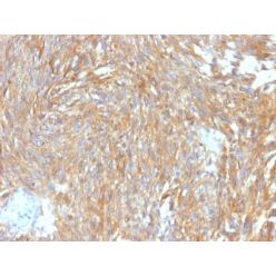 DOG-1 / TMEM16A (Gastrointestinal Stromal Tumor Marker) (DG1/2564R), 1mg/mL