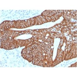 Cytokeratin 18 (KRT18) (KRT18/2819R), 1mg/mL