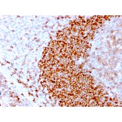 CD79b (B-Cell Marker)(IGB/3170R), 1mg/mL