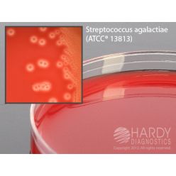 Hardy Diagnostic A300 Dry Culture Media, GBS Detect Plate,  70 Day Shelf Life (Pack of 10)