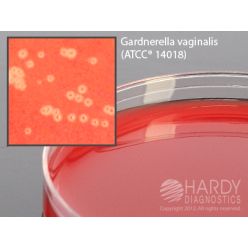 Hardy Diagnostic A81 Dry Culture Media, V Agar w/ CNA Plate,  42 Day Shelf Life (Pack of 10)