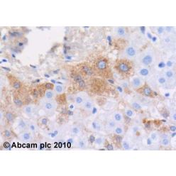 Abcam AB1006-50UG Anti-Plasma Kallikrein 1B Mouse Monoclonal Antibody [clone: 13G11] (1/EA)