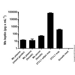 Abcam AB100718-1X96TESTS Mouse Leptin ELISA Kit (1/EA)