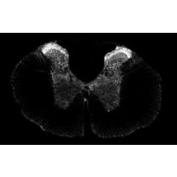 Abcam AB100881-100UL Anti-Somatostatin Receptor 1/SSTR1 Rabbit Polyclonal Antibody (1/EA)