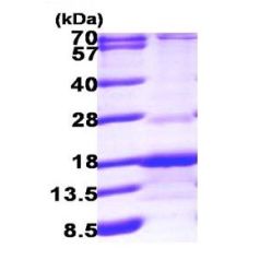 Abcam AB100886-250UG Human Recombinant RABIF (from E. coli) (1/EA)