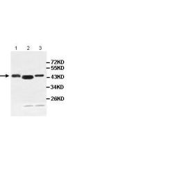 Abcam AB100915-100UG Anti-ACOT1 Rabbit Polyclonal Antibody (1/EA)