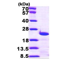 Abcam AB100940-500UG Human Recombinant Centrin 3 (from E. coli) (1/EA)