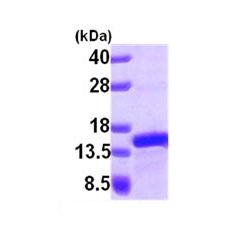 Abcam AB101047-10UG Human Recombinant PFDN1 (from E. coli) (1/EA)
