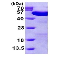 Abcam AB101048-100UG Human Recombinant PDIA6 (from E. coli) (1/EA)