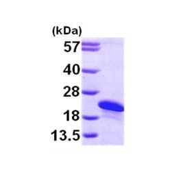 Abcam AB101067-500UG Human Recombinant ARL2BP (from E. coli) (1/EA)