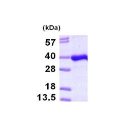 Abcam AB101091-100UG Human Recombinant PITPNB (from E. coli) (1/EA)