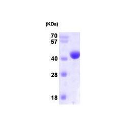 Abcam AB101109-100UG Human Recombinant NANS (from E. coli) (1/EA)