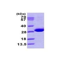 Abcam AB101110-50UG Human Recombinant CBR4 (from E. coli) (1/EA)