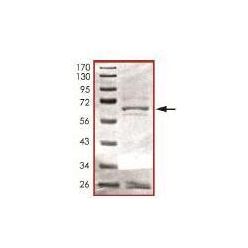 Abcam AB101113-10UG Human Recombinant HDAC11/HD11 (from Baculovirus (Insect cells)) (1/EA)
