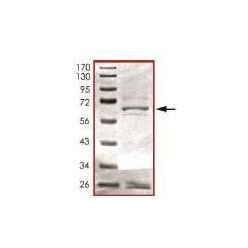 Abcam AB101113-5UG Human Recombinant HDAC11/HD11 (from Baculovirus (Insect cells)) (1/EA)