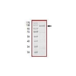 Abcam AB101115-5UG Human Recombinant PERK (from E. coli) (1/EA)