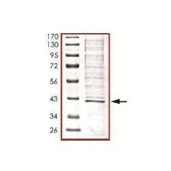 Abcam AB101132-5UG Human Recombinant SIRT2 (from Baculovirus (Insect cells)) (1/EA)