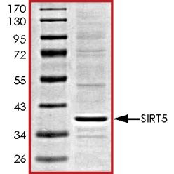 Abcam AB101134-10UG Human Recombinant SIRT5 (from Baculovirus (Insect cells)) (1/EA)