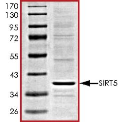 Abcam AB101134-5UG Human Recombinant SIRT5 (from Baculovirus (Insect cells)) (1/EA)