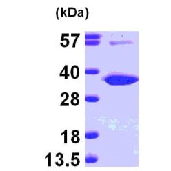 Abcam AB101152-50UG Human Recombinant Uridine Phosphorylase 1 (from E. coli) (1/EA)
