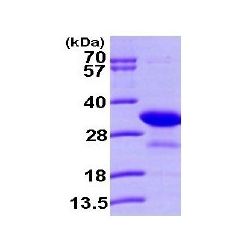 Abcam AB101155-250UG Human Recombinant PHAP1 (from E. coli) (1/EA)