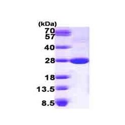 Abcam AB101156-100UG Mouse Recombinant Lysophospholipase 1/LPL-I (from E. coli) (1/EA)