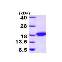 Abcam AB101158-50UG Human Recombinant THEM2 (from E. coli) (1/EA)