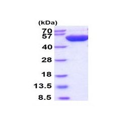 Abcam AB101169-100UG Human Recombinant Thymidine Phosphorylase (from E. coli) (1/EA)