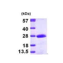 Abcam AB101170-100UG Human Recombinant Phosphomevalonate kinase (from E. coli) (1/EA)
