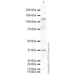 Abcam AB101228-100UG Anti-LIFR Rabbit Polyclonal Antibody (1/EA)