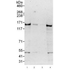 Abcam AB101282-100UG Anti-UBN1 Rabbit Polyclonal Antibody (1/EA)