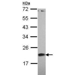 Abcam AB101332-50UL Anti-Centrin 1 Rabbit Polyclonal Antibody (1/EA)