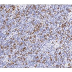Abcam AB101500-100UL Anti-CD8 alpha Rabbit Monoclonal Antibody [clone: SP16] (1/EA)