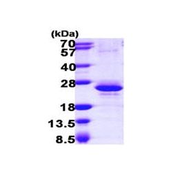 Abcam AB105606-50UG Human Recombinant Y14 (from E. coli) (1/EA)