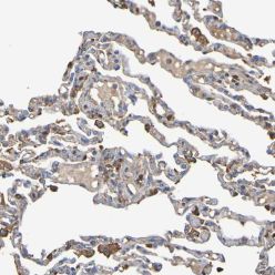 Abcam AB121311-100UL Anti-GAB3 Rabbit Polyclonal Antibody (1/EA)