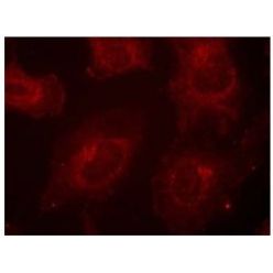 Abcam AB131458-100UG Anti-GAB1 (phospho Y627) Rabbit Polyclonal Antibody (1/EA)