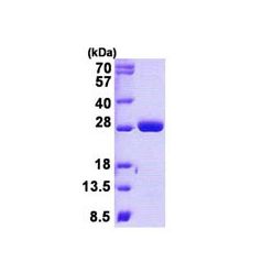 Abcam AB140717-100UG Human Recombinant MOB4A (from E. coli) (1/EA)