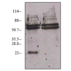 Enzo ADI-905-164-100 VEGF monoclonal antibody (6B7) (100 µg)
