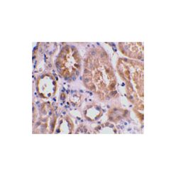 Enzo ADI-905-185-100 Bnip3L (IN) polyclonal antibody (100 µg)