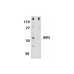 Enzo ADI-905-242-100 RIP3 polyclonal antibody (100 µg)