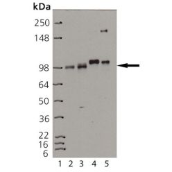 Enzo ADI-905-683-100 Insulin receptor β monoclonal antibody (C18C4) (100 µg)