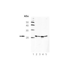 Enzo ADI-905-684-100 Smac/DIABLO monoclonal antibody (79-1-83) (100 µg)