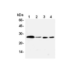 Enzo ADI-AAM-072-E Bcl-2 monoclonal antibody (83-8B) (100 µg)