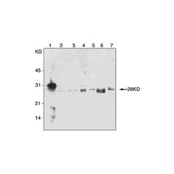 Enzo ADI-AAM-212-E FADD monoclonal antibody (1F7) (100 µg)