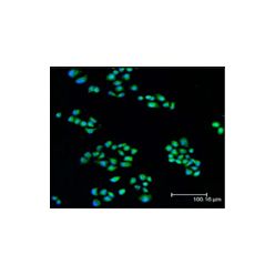 Enzo ADI-AAP-240-F Mcl-1 polyclonal antibody (200 µg)