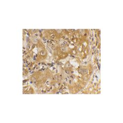 Enzo ADI-AAP-330-E Bim/BOD polyclonal antibody (100 µg)